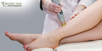 5 FAQs About Laser Hair Removal in South Surrey Answered